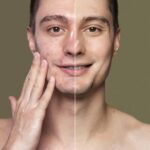 before after portrait young man retouched