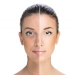 how to remove tanning